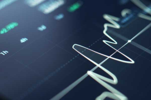 黄金概念股回调，西部黄金一度跌超9%